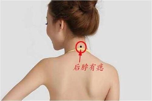 脖子有痣图片,独特魅力与神秘寓意